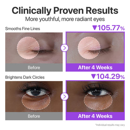 No.9 NAD + Retinol Volumetox Eye Cream