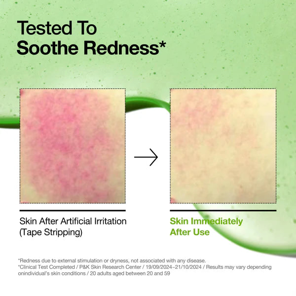 Azelaic Acid 10% Hyaluron Redness Soothing Serum